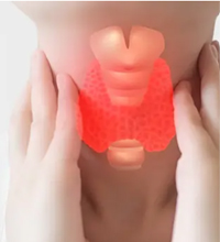 Thyroid Disorders
